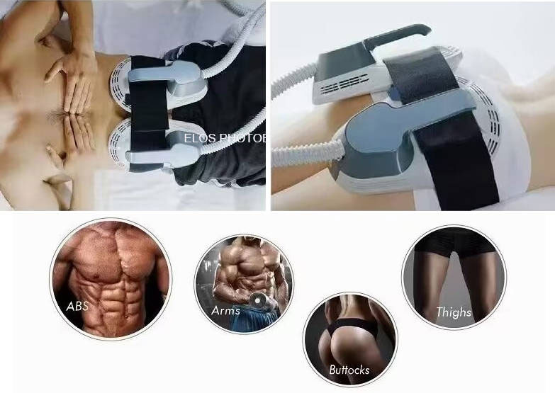 Miért válik az EMS Sculpture Machine egyre népszerűbb az egész világon?